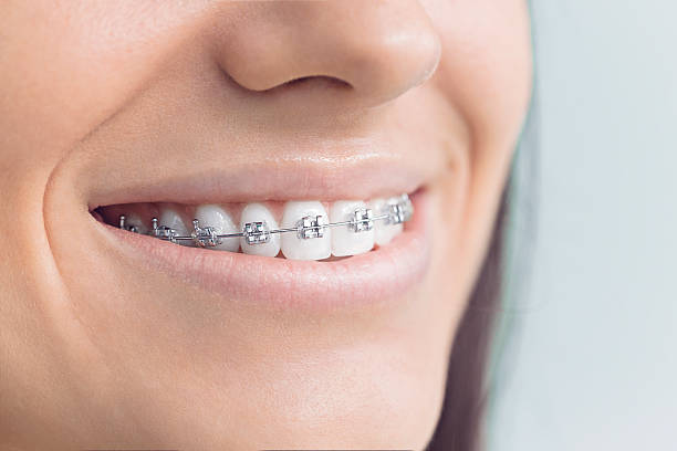 Best Dental Inlays and Onlays  in Harb, OR